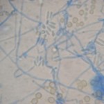 Acremonium_Mikroskopie